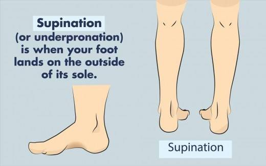 The Three Kinds of Foot Strikes: Pronation, Supination, and Neutral