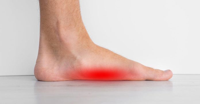 Do insoles help with flat feet