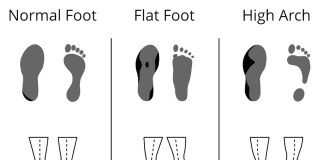 can i transfer insoles between different pairs of shoes 1