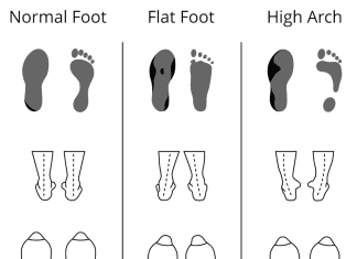 can i transfer insoles between different pairs of shoes 1