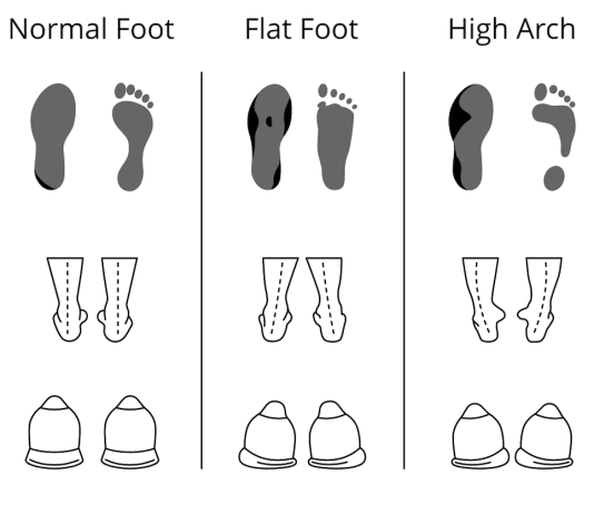 can i transfer insoles between different pairs of shoes 1