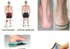 can i use custom orthotic insoles in any shoe 4