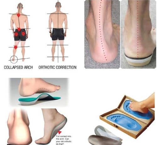 can i use custom orthotic insoles in any shoe 4