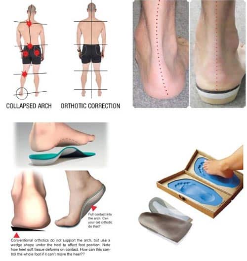 can i use custom orthotic insoles in any shoe 4