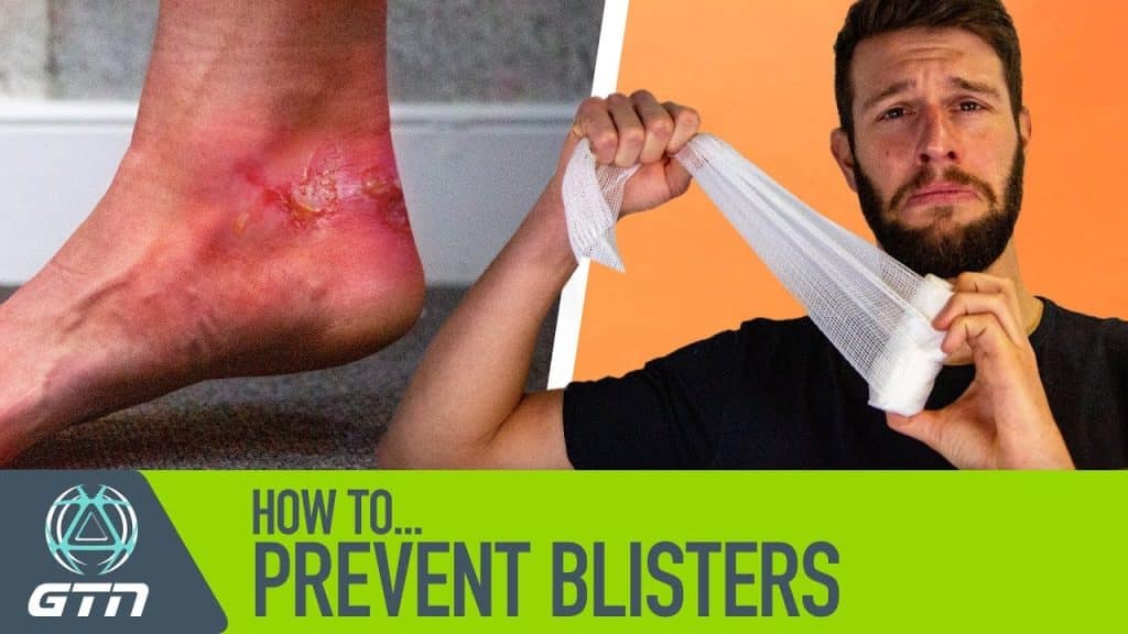 How Can I Prevent Blisters While Running?