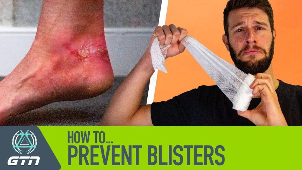 How Can I Prevent Blisters While Running?