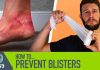 how can i prevent blisters while running 2