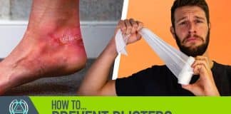 how can i prevent blisters while running 2