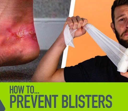 Can Insoles Help Prevent Injuries Or Overuse Syndromes? how can i prevent blisters while running 2