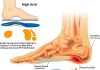 the top metatarsal insoles for maximum comfort 3