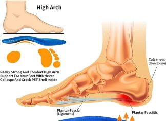 the top metatarsal insoles for maximum comfort 3