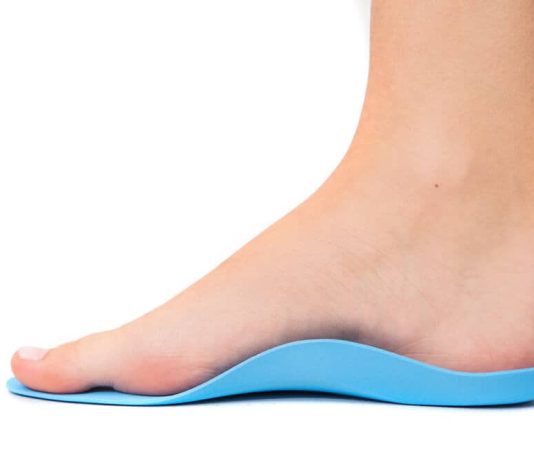 Do Over The Counter Orthotics Work