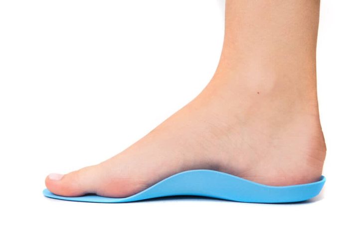 Do Over The Counter Orthotics Work