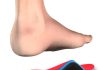 How Do Insoles Provide Arch Support