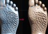 can orthotic insoles help with flat feet