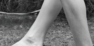 is barefoot better than orthotics