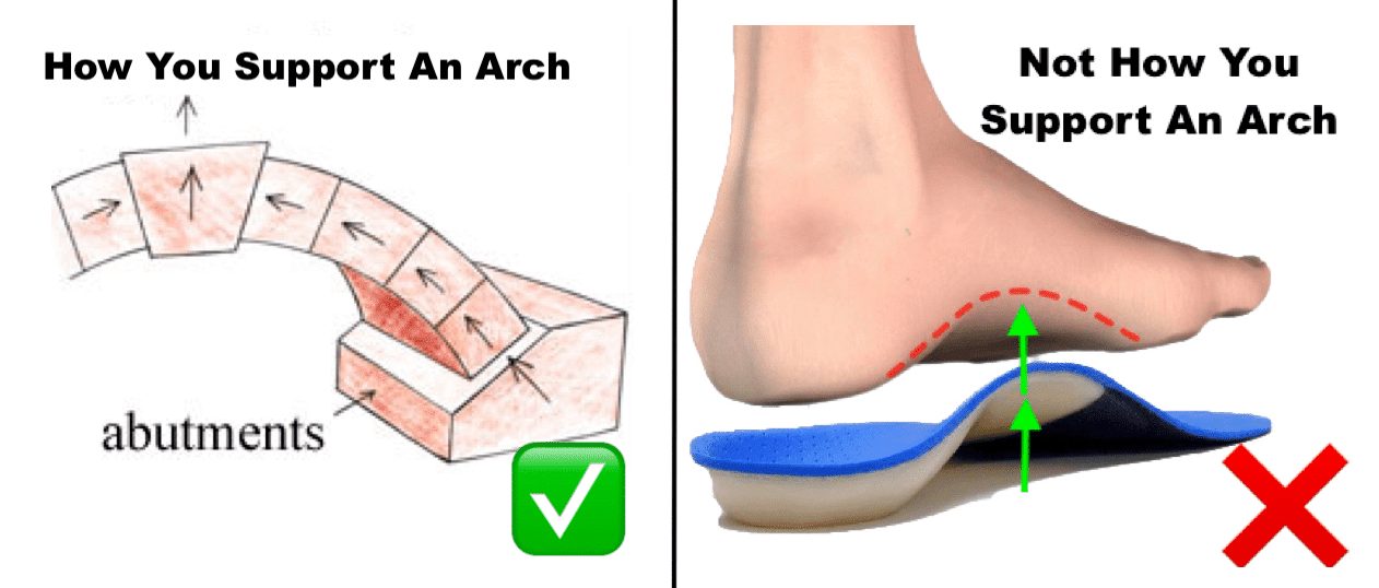 Should You Wear Arch Supports All The Time?
