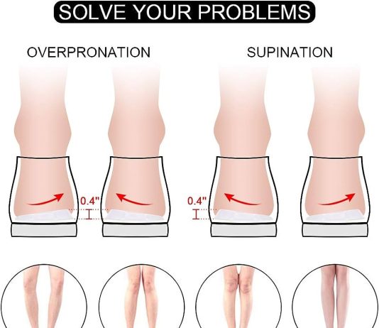 can insoles help correct overpronation or supination