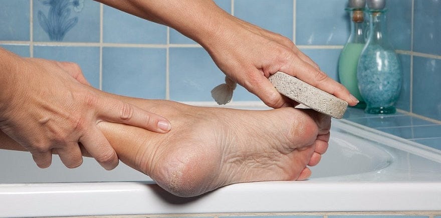 Can Insoles Help Prevent Calluses And Corns On The Feet?