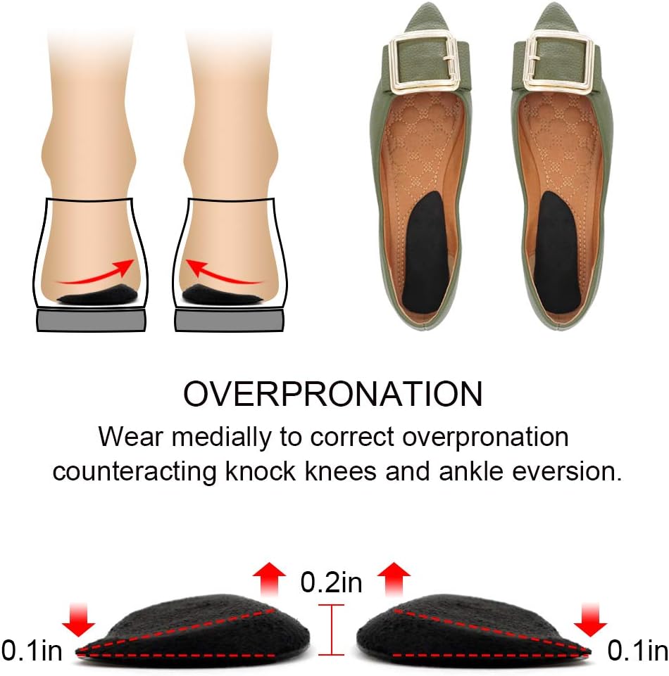 Dr. Foots Supination  Over-Pronation Corrective Shoe Inserts, Medial  Lateral Heel Wedge Insoles for Foot Alignment, Knee Pain, Bow Legs, Osteoarthritis - 3 Pairs (Beige)