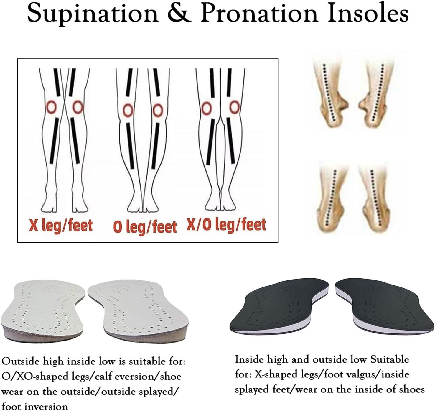 O/X Leg Orthopedic Insoles, 1 Pair Correcting Supination Insoles, Leather Wedges Shoe Inserts for Over Supination, Foot Alignment (Color : White/Supination, Size : 41-42)