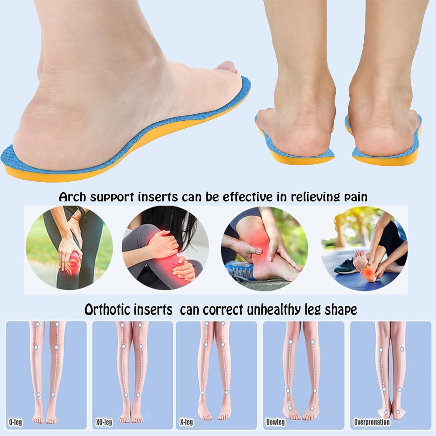 Supination Insoles,Arch Support Inserts,Plantar Fasciitis Orthotic Insoles for Rectify Flat Feet,X Type Legs,Bow Legs,Relief Pronation,Arch Feet Pain,Heel Pain ( Color : Supination , Size : 43-44 )