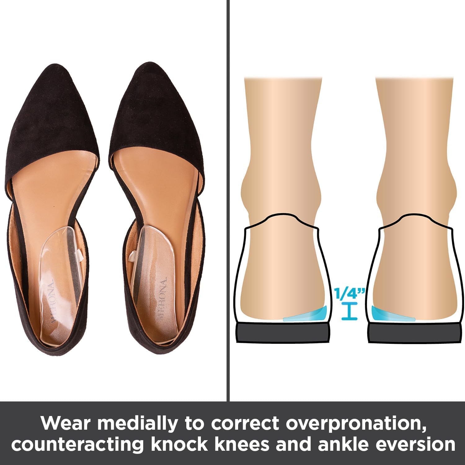 BraceAbility Medial Lateral Heel Wedge Silicone Insoles (Pair) - Supination Pronation Corrective Adhesive Shoe Inserts for Foot Alignment, Knock Knee Pain, Bow Legs, Osteoarthritis
