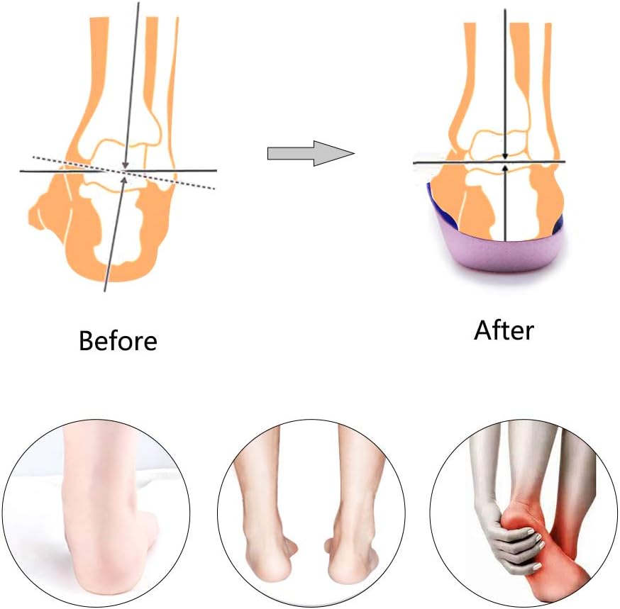 PCSsole 3/4 Orthotics Shoe Insoles High Arch Supports Shoe Insertsfor Plantar Fasciitis, Flat Feet, Over-Pronation, Relief Heel Spur Pain (Men11.5-13.5/Women12.5-14.5)