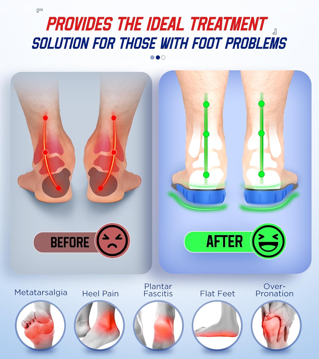 240+lbs Heavy Duty High Arch Support Orthotic Insoles for Plantar Fasciitis Pain Relief - For Men, Women, Work Boots, Shoes
