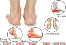 Different Heights Arch Support Insoles review