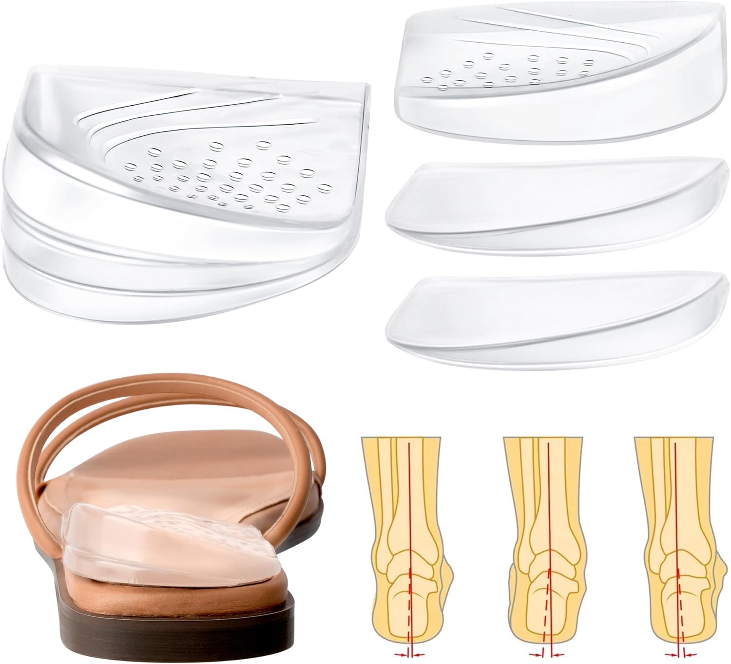 Adjustable Heel Wedge Inserts Layers for Supination Pronation Correction, Medial Lateral Heel Insoles for Knee Pain, Foot Alignment, Bow Legs, Men, Women (Transparent, Large) Adjustable Heel Wedge Inserts Layers for Supination Pronation Correction, Medial Lateral Heel Insoles for Knee Pain, Foot Alignment, Bow Legs, Men, Women (Transparent, Large)
