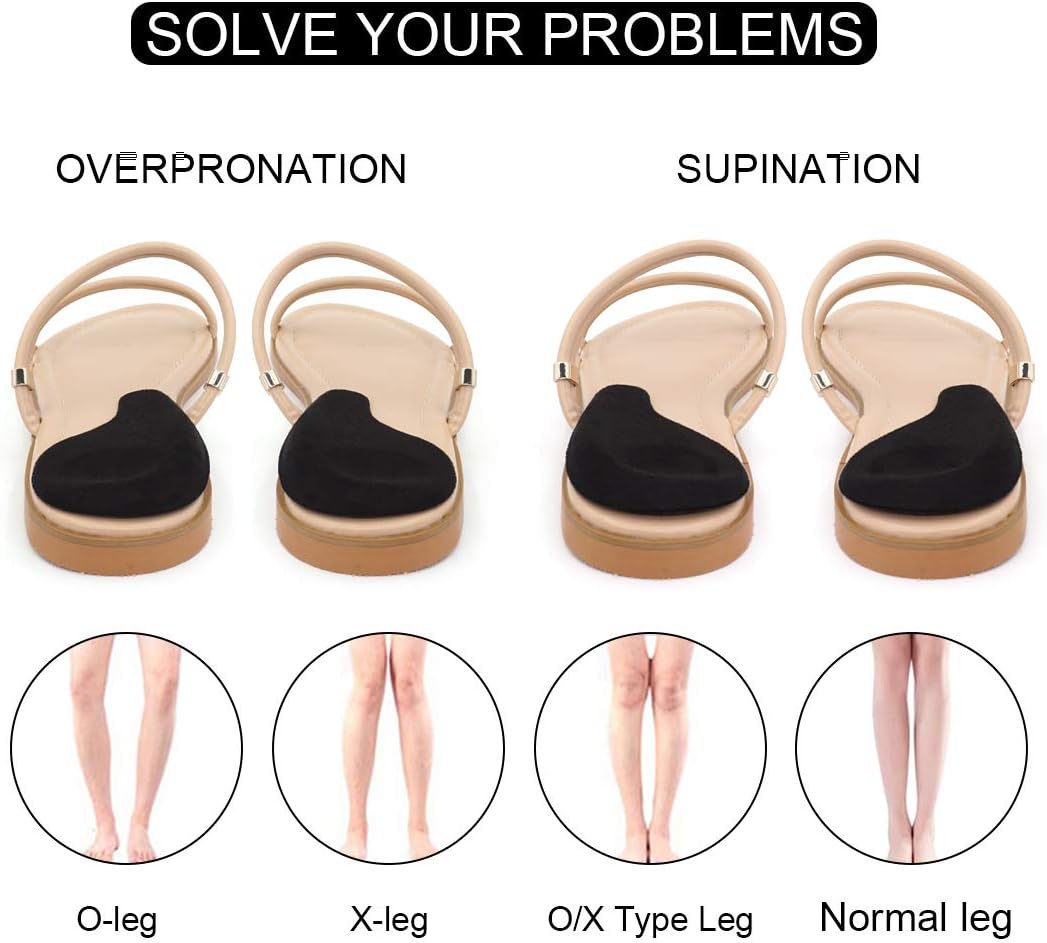 Dr. Foots Supination Insoles Overpronation Insoles, Medial Lateral Heel Cups for Foot Alignment, Knee Pain, Bow Legs, Osteoarthritis Dr. Foots Supination Insoles Overpronation Insoles, Medial Lateral Heel Cups for Foot Alignment, Knee Pain, Bow Legs, Osteoarthritis