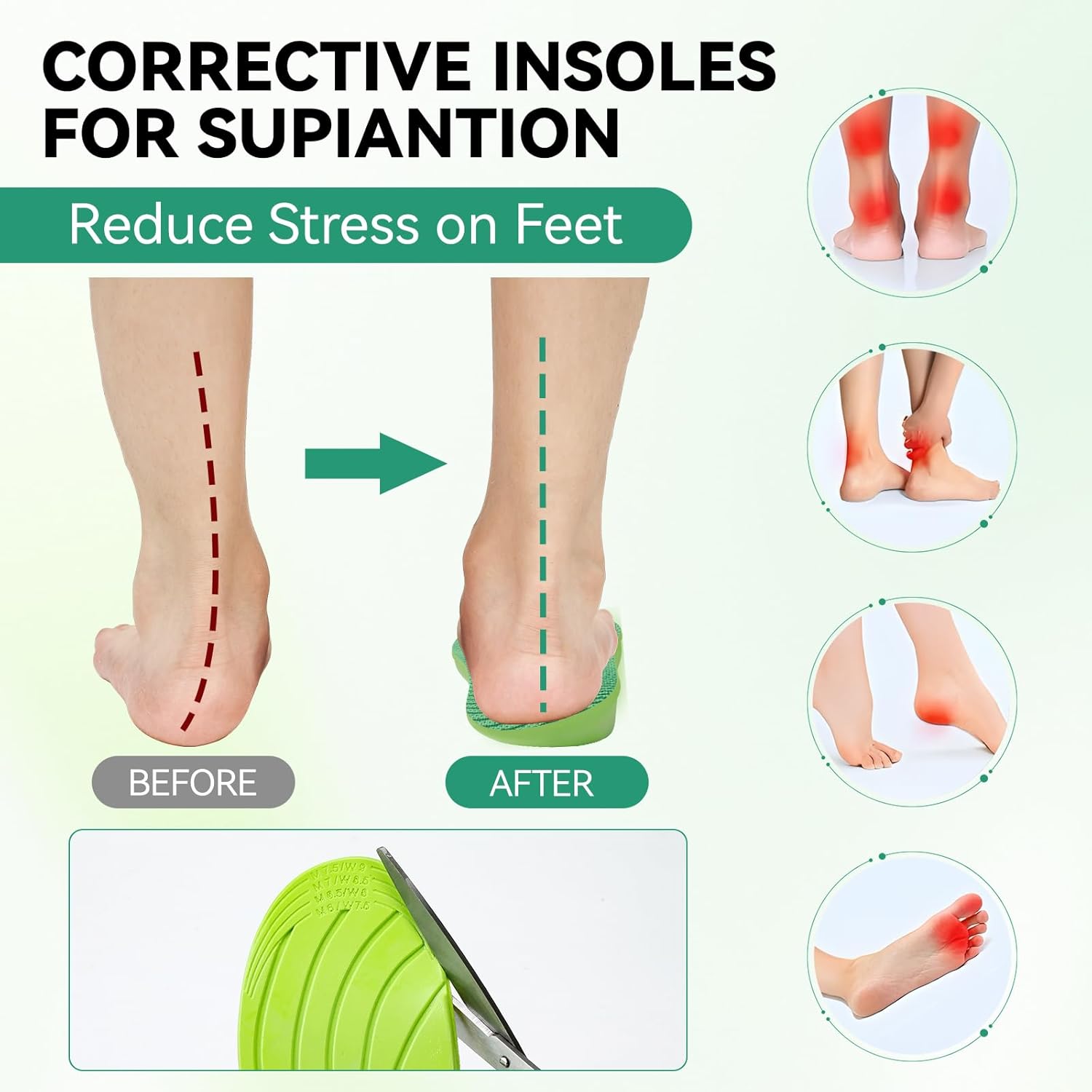 Supination Correction Insoles for Men and Women, O/XO Leg Orthopedic Corrective Insoles and Arch Support Comfort Cushion Inserts for Bow Legs, Foot Alignment, Posture Improve (M: M 8-9.5/W 9.5-11) Supination Correction Insoles for Men and Women, O/XO Leg Orthopedic Corrective Insoles and Arch Support Comfort Cushion Inserts for Bow Legs, Foot Alignment, Posture Improve (M: M 8-9.5/W 9.5-11)
