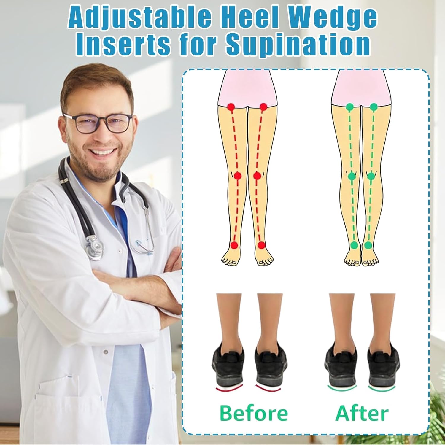 6PCS Adjustable Heel Wedge Inserts for Supination Overpronation Insoles Correction, Orthotic Insoles for Over Pronation Correction Insoles (L: W 7-11, M 7-10 Layers)-0.40.20.2 6PCS Adjustable Heel Wedge Inserts for Supination Overpronation Insoles Correction, Orthotic Insoles for Over Pronation Correction Insoles (L: W 7-11, M 7-10 Layers)-0.40.20.2